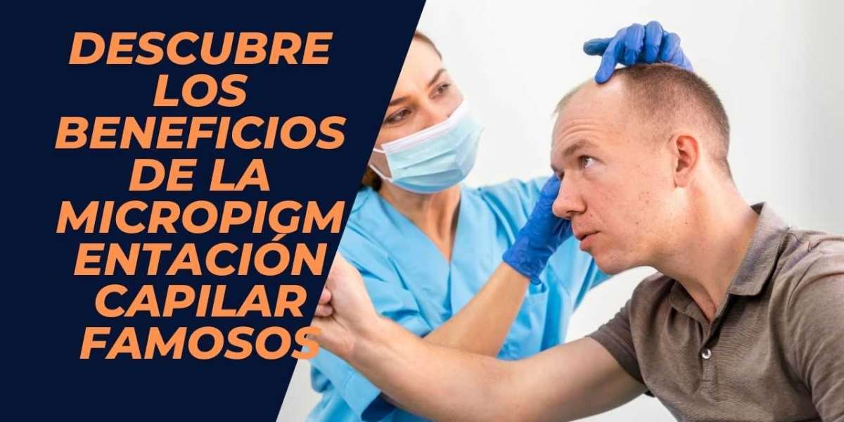 Descubre los Beneficios de la Micropigmentación Capilar Famosos