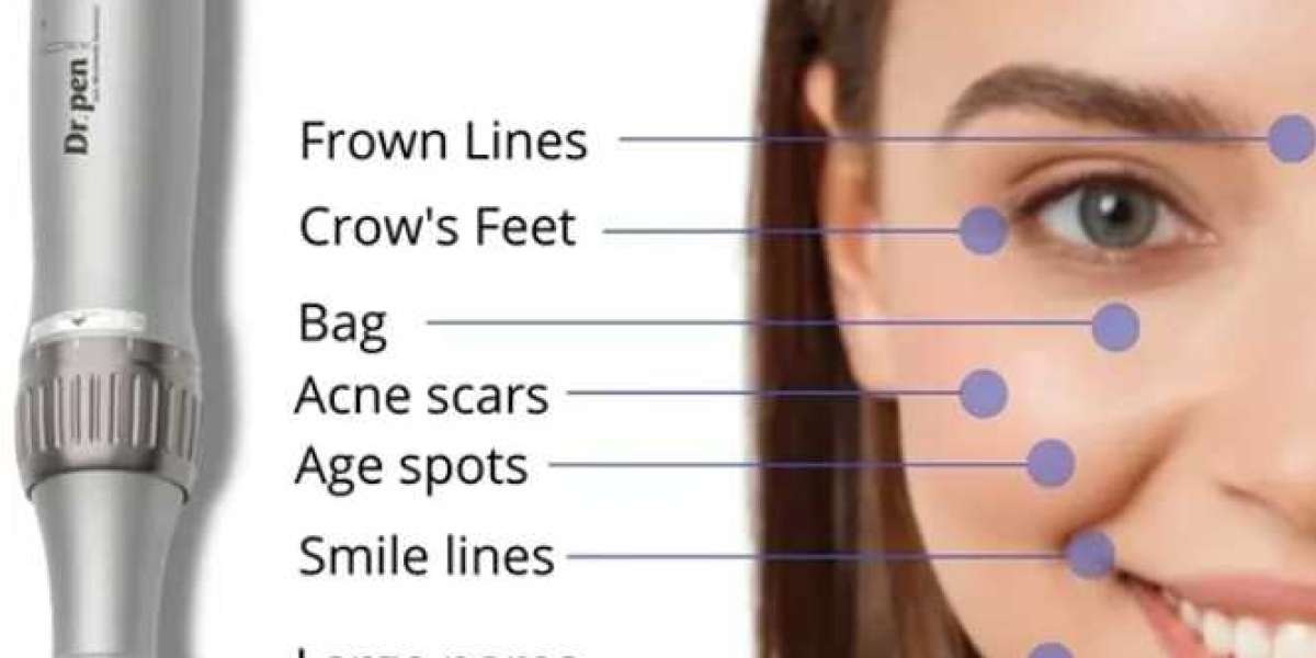 Microneedling: Wie effektiv ist es wirklich?